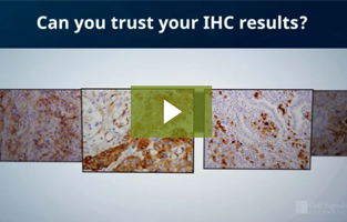 自分の免疫組織化学染色 (IHC) の結果を信頼できますか？